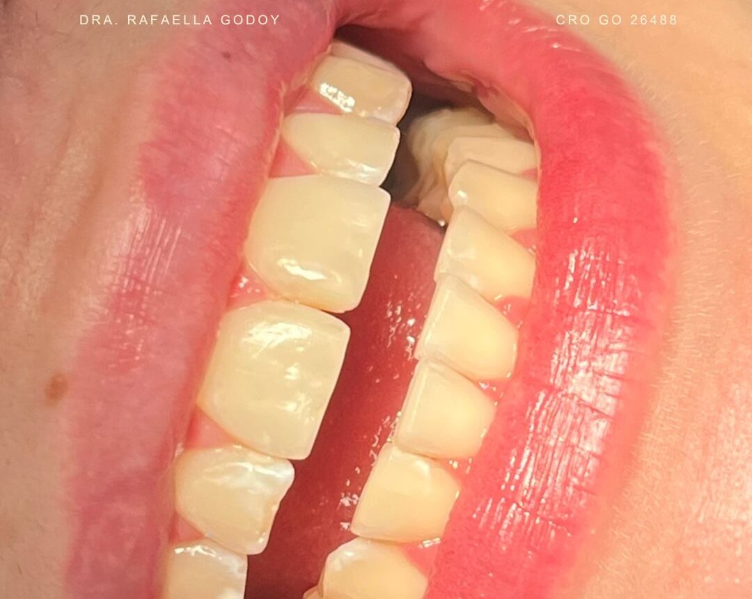 Sorriso com dentes saudáveis